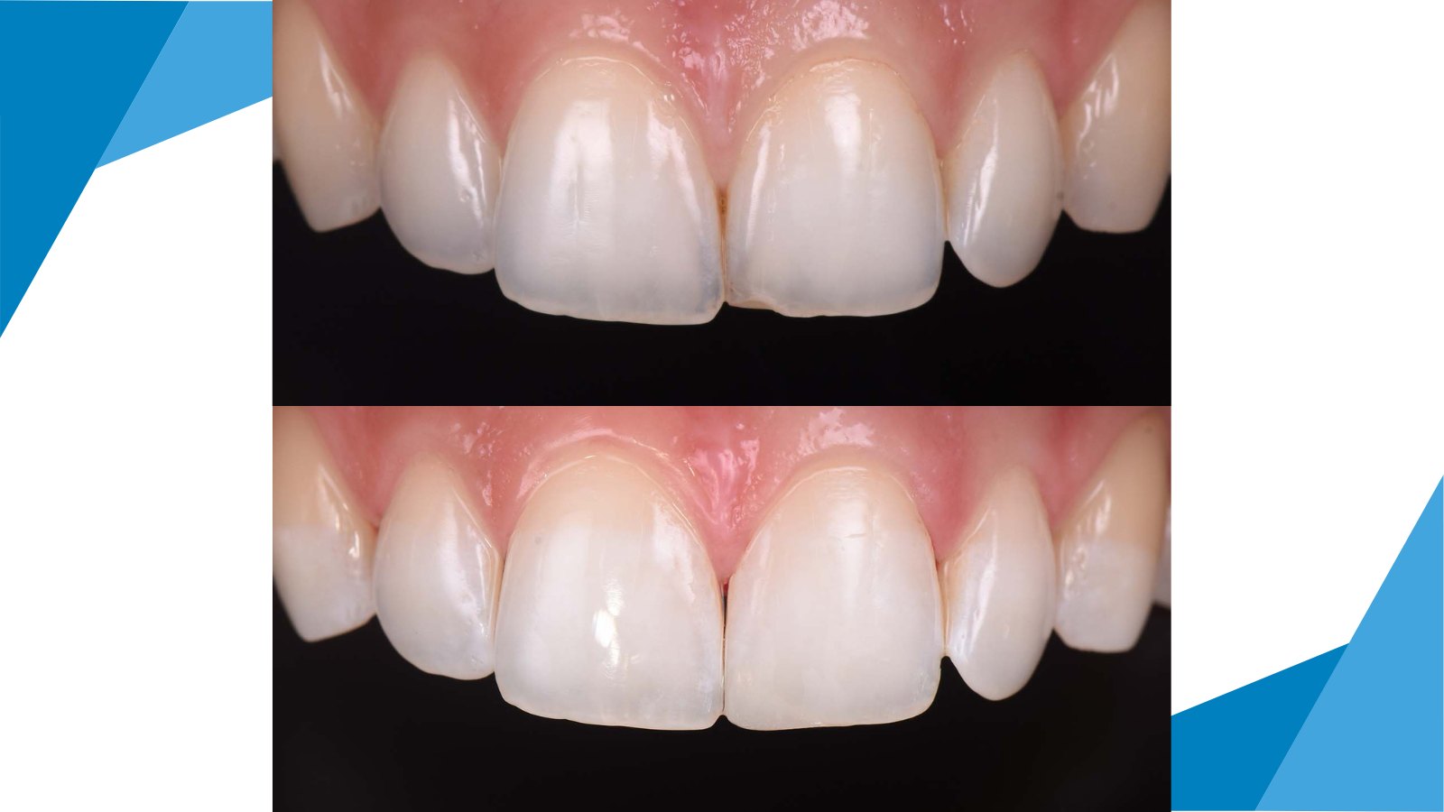 Before after case by Dr Laura Mokhtari