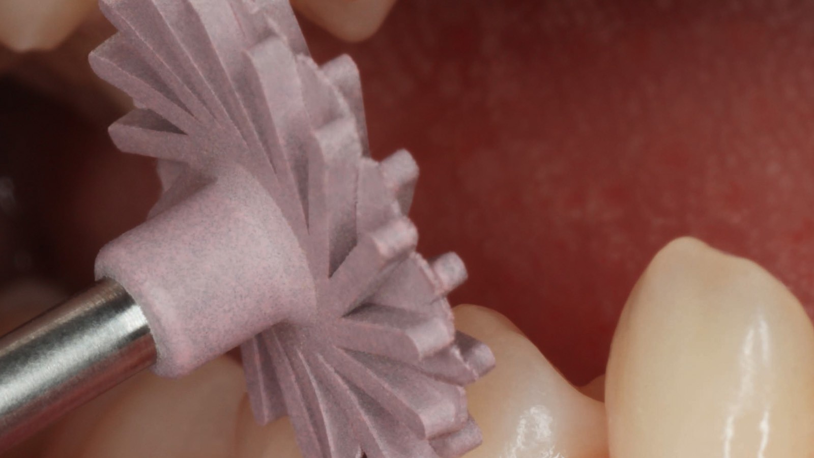 Buccal