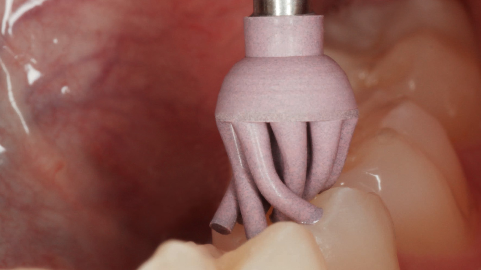 The brush bristles can be bent for easy access to fissures