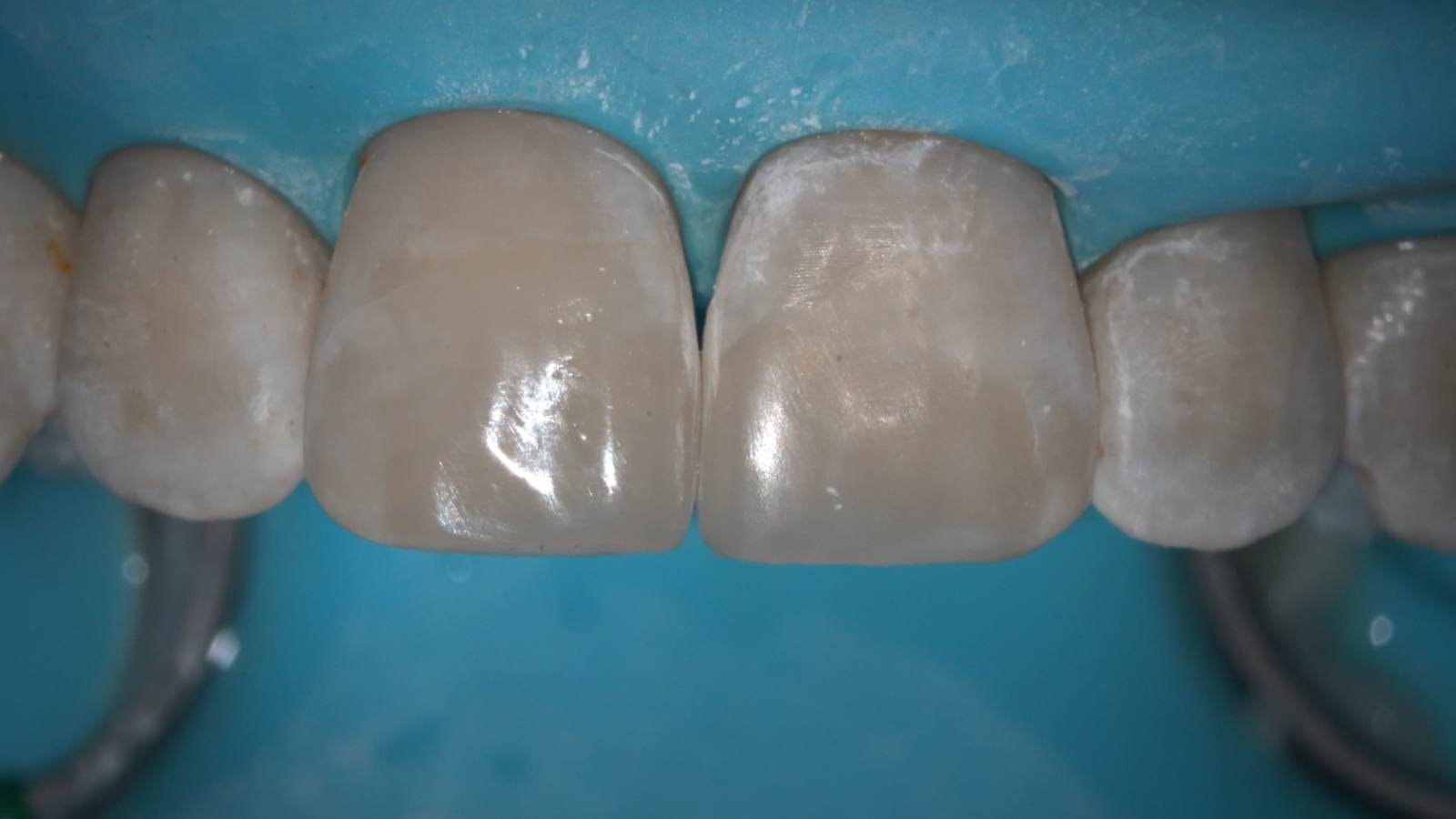 Click and hold the green slider. Move from side to side to reveal the before-and-after pictures.