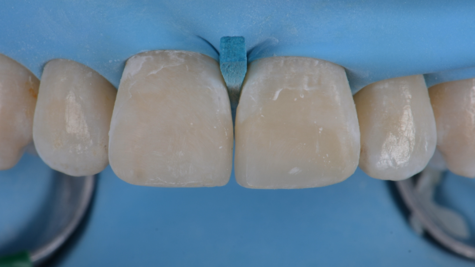 Click and hold the green slider. Move from side to side to reveal the before-and-after pictures.