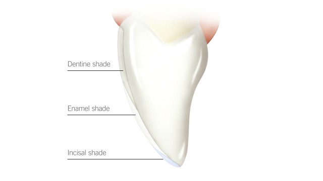 Different tooth shades: dentine, enamel and incisal