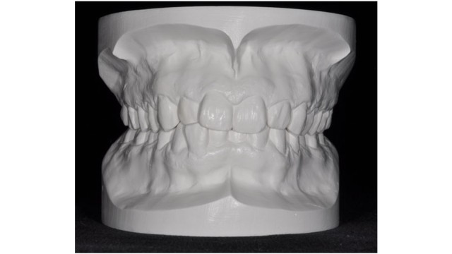 Diagnostic models in occlusion