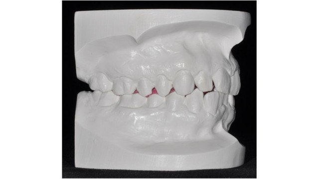 Right lateral view of diagnostic model