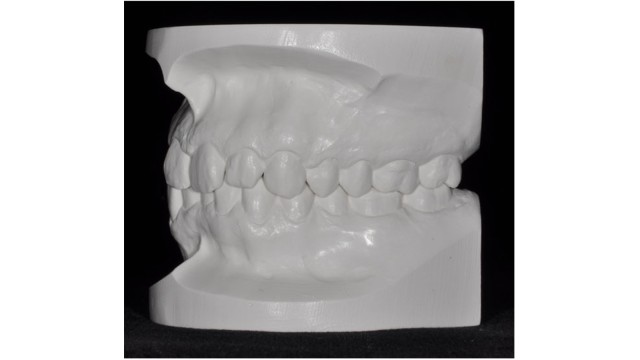 Left lateral view of diagnostic model