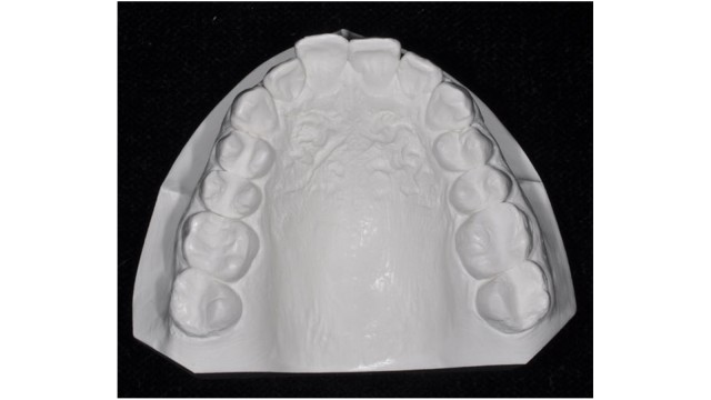 Diagnostic model of maxilla