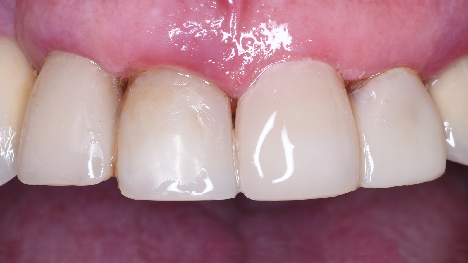 Click and hold the green slider. Move from side to side to reveal the before-and-after pictures.