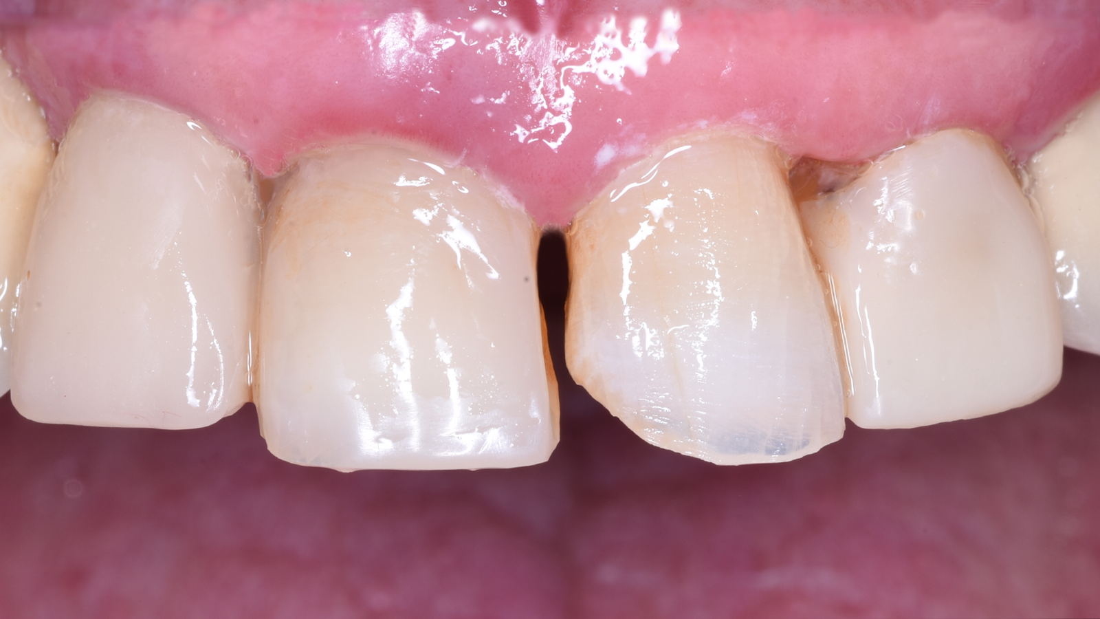 Click and hold the green slider. Move from side to side to reveal the before-and-after pictures.