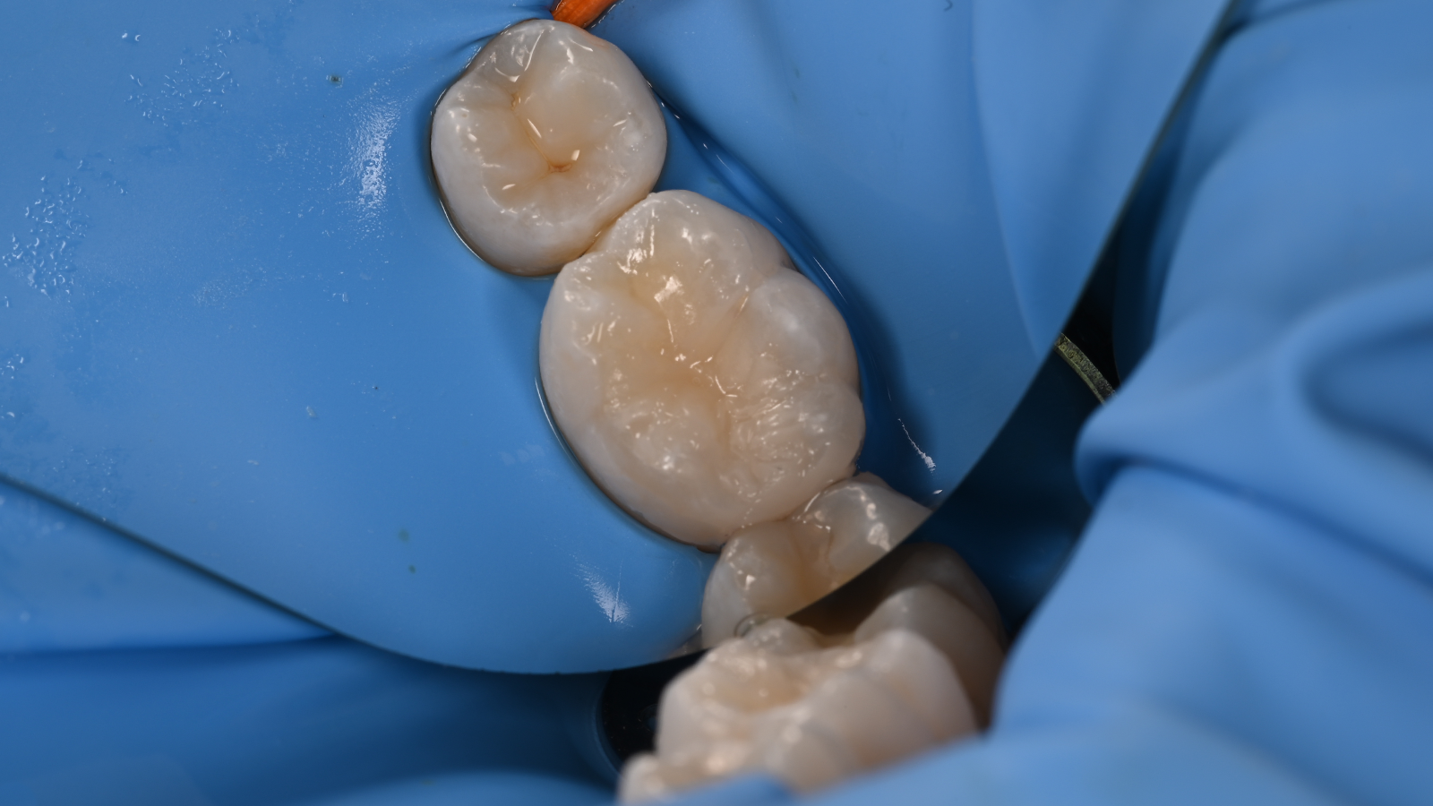 Final filling before adjustments