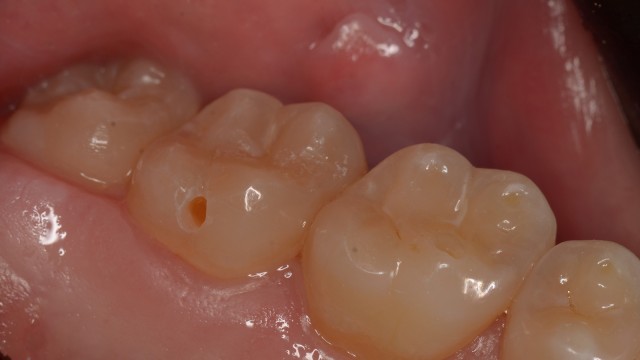 Before