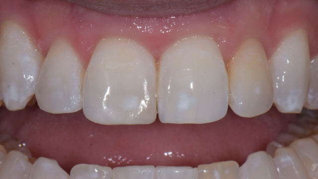 After