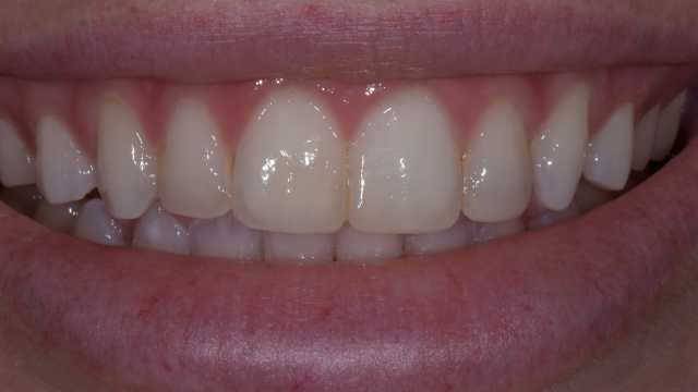 After