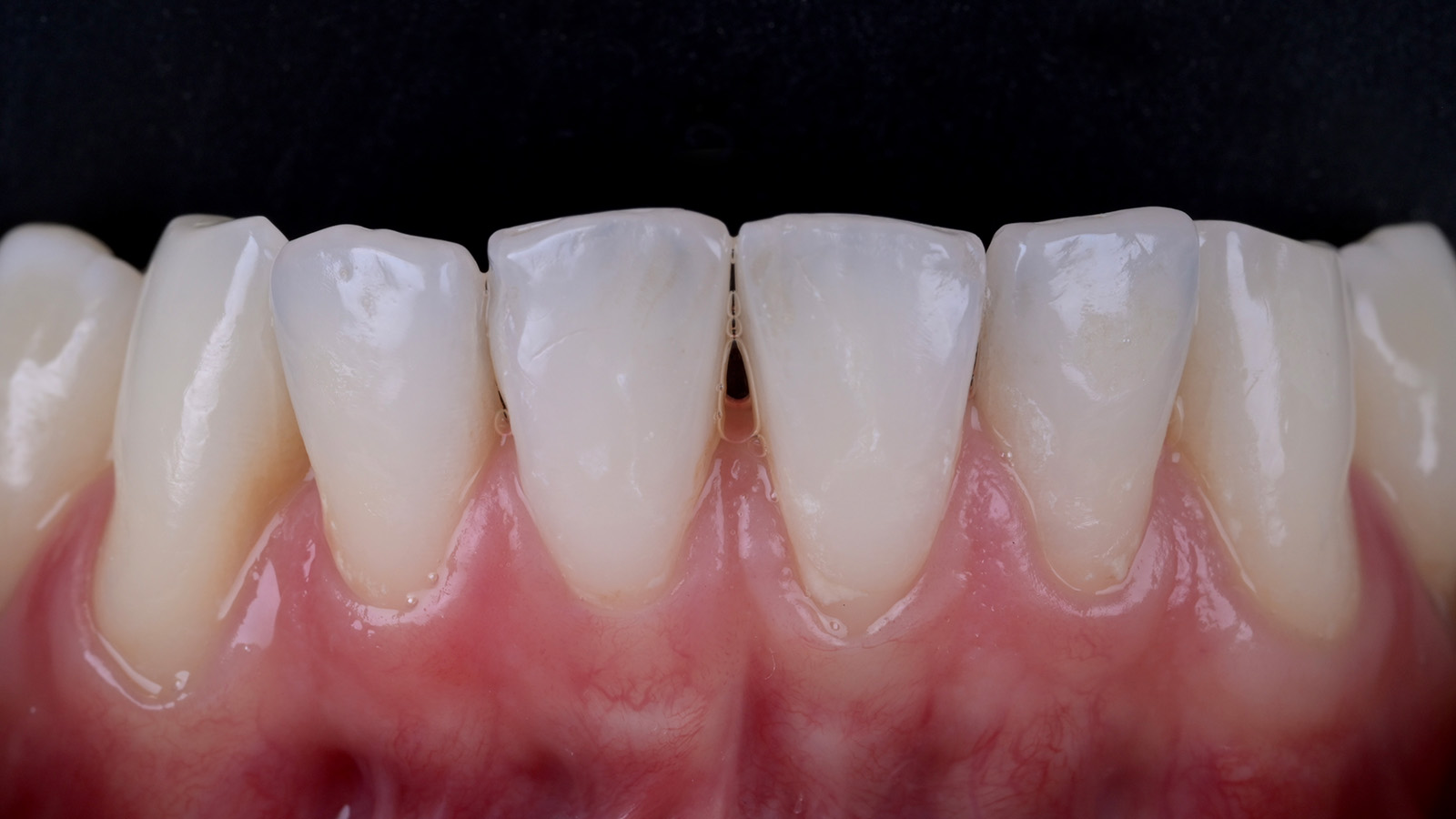 Click and hold the green slider. Move from side to side to reveal the before-and-after pictures.