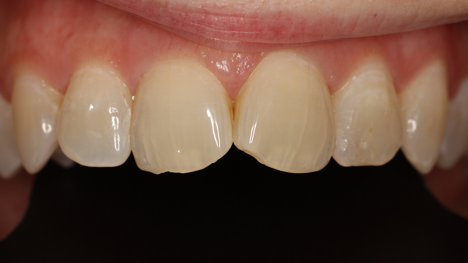 Click and hold the green slider. Move from side to side to reveal the before-and-after pictures.