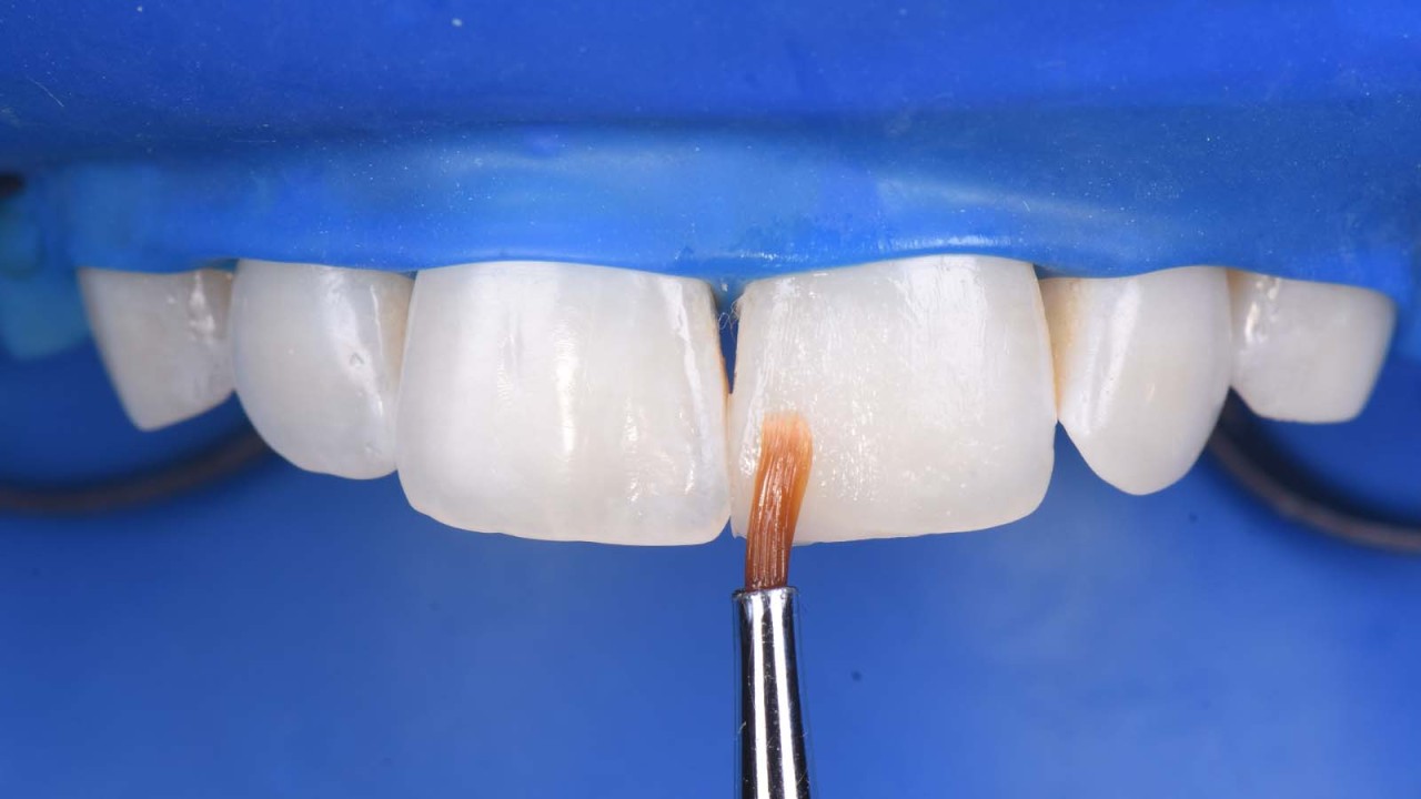 Clinical case from Dr Laura Mokhtari