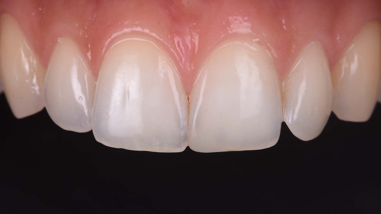 Final result after 1 month. 