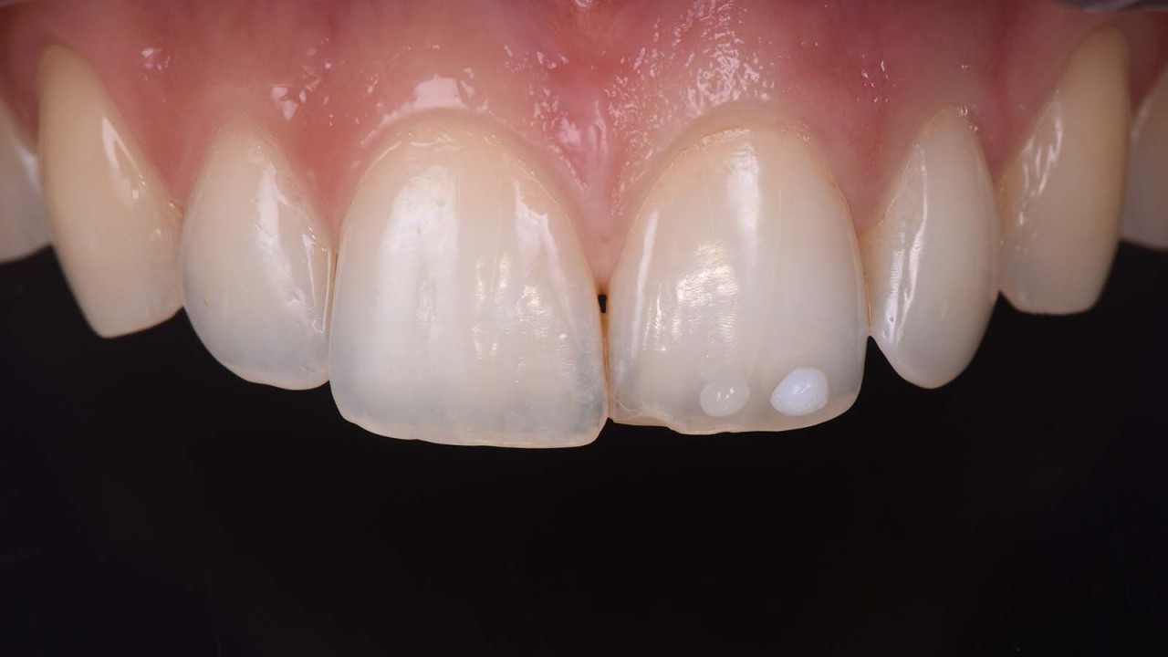 Clinical case from Dr Laura Mokhtari