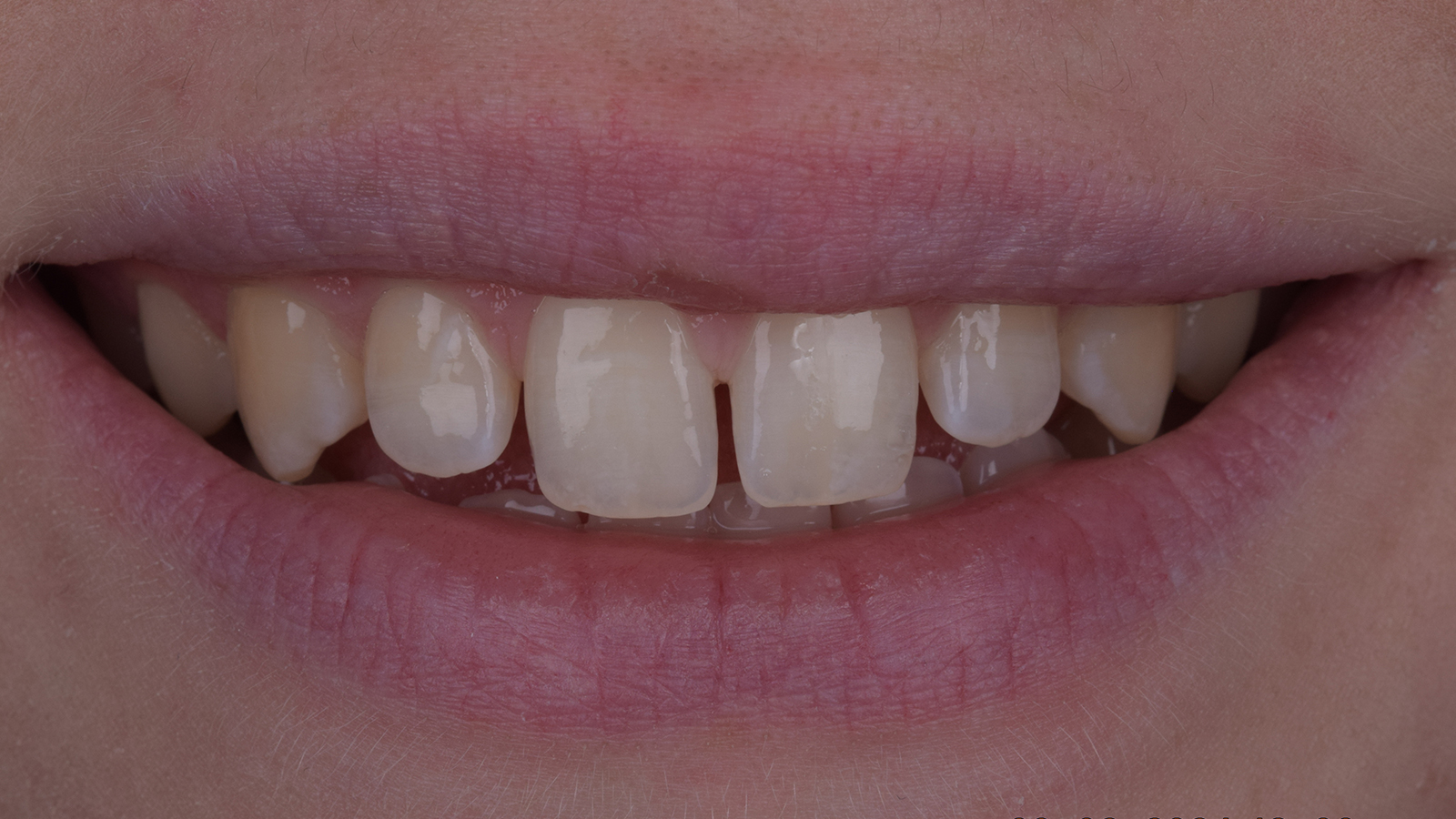 Click and hold the green slider. Move from side to side to reveal the before-and-after pictures.