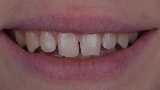 Before
